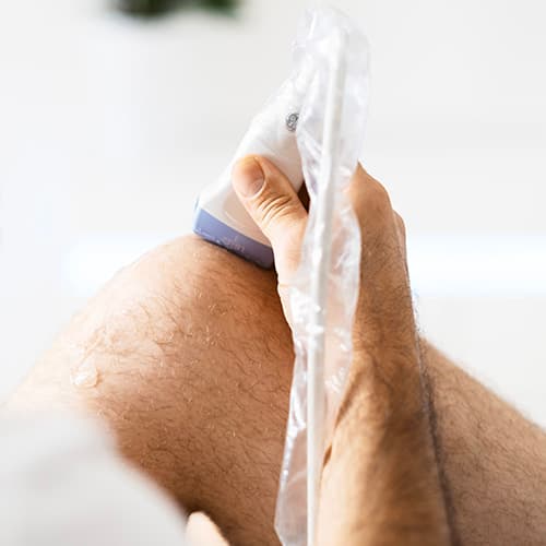 Knorpelregeneration bei Gelenkschäden in Baden-Württemberg